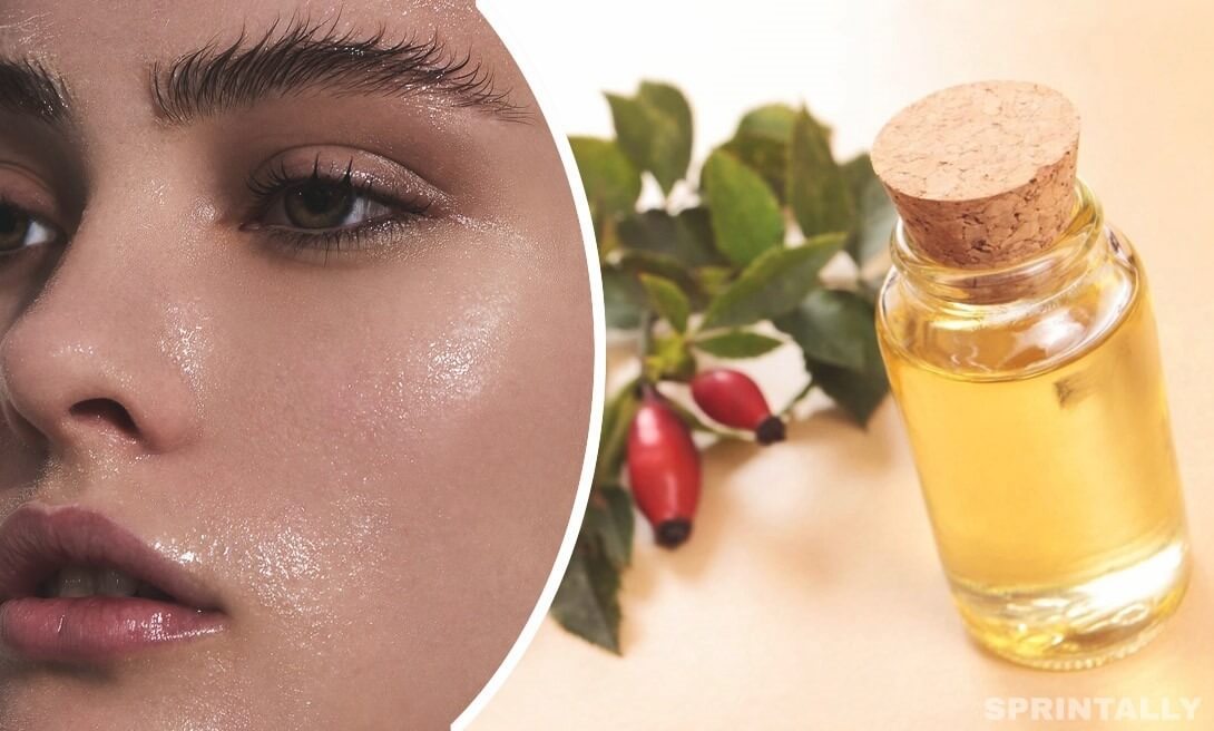 Rosehip oil