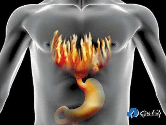 acid reflux